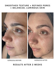 Before and after image showing smoothed texture, refined pores,and balanced, luminous skin