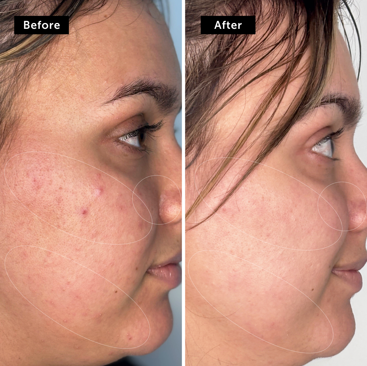 Before_after.png