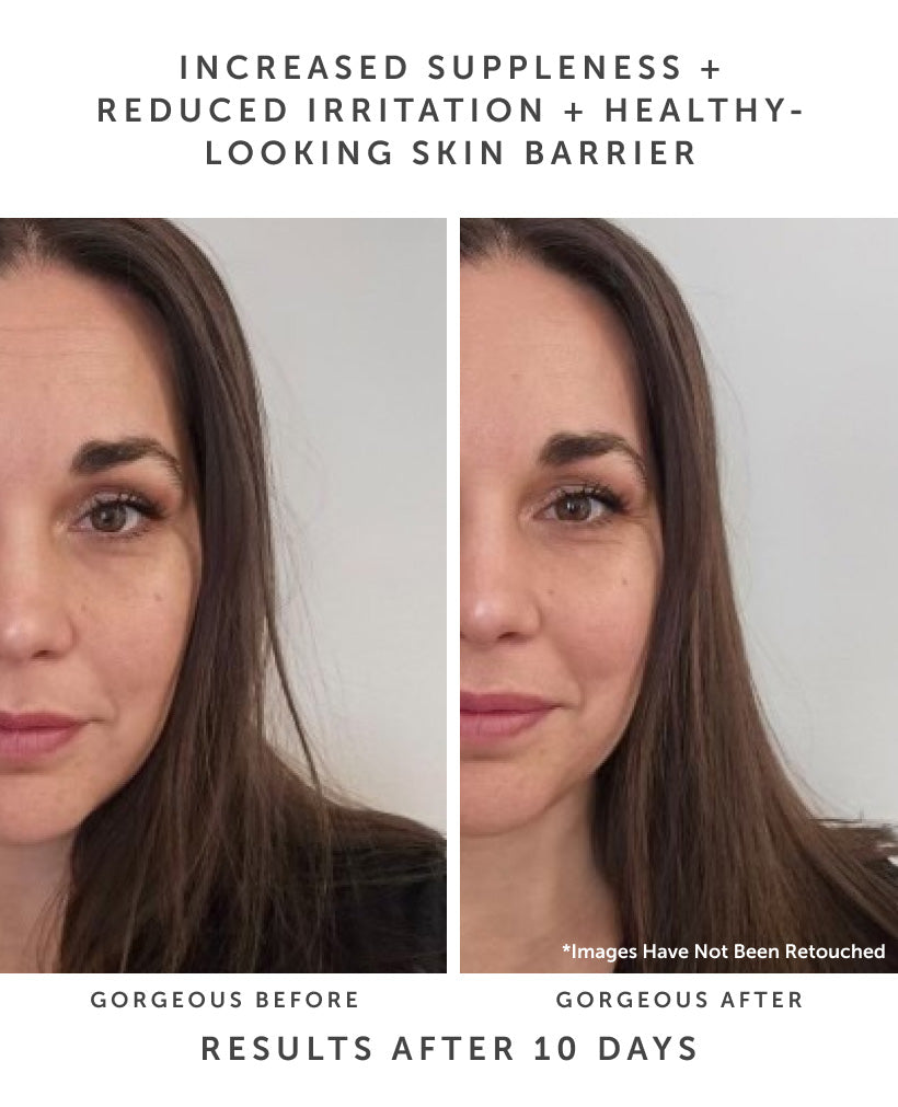 HORIZON Ceramide Repair Serum - Earth Harbor Naturals