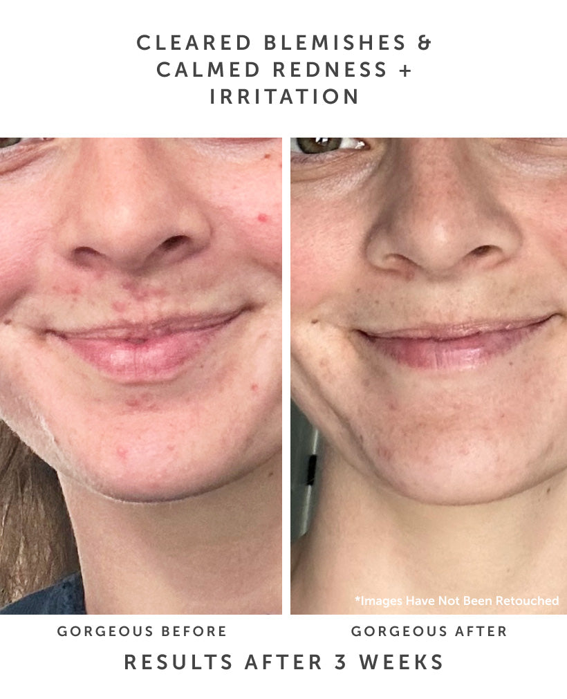 SAMPHIRE BHA Clarifying Serum - Earth Harbor Naturals